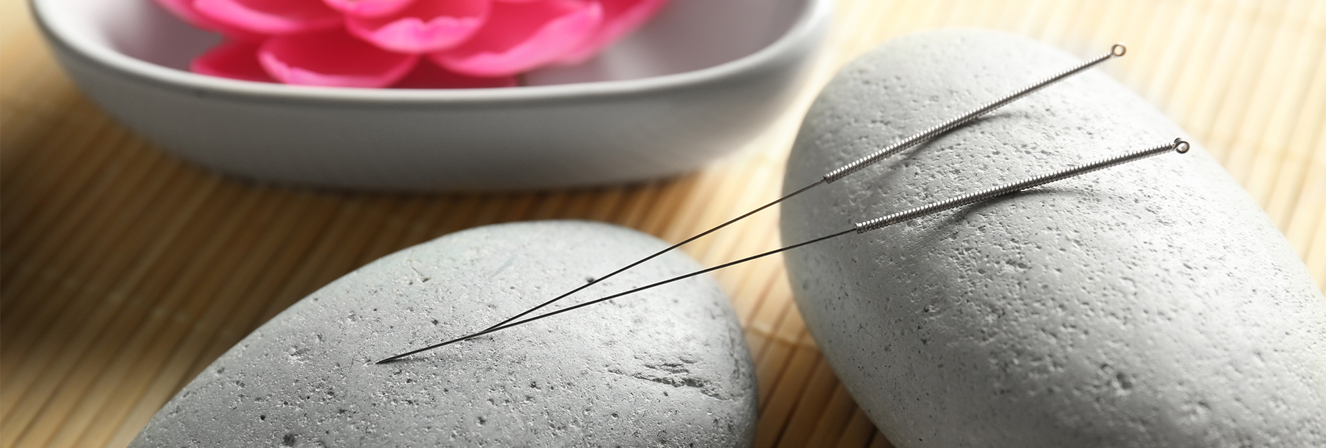 acupuncture
